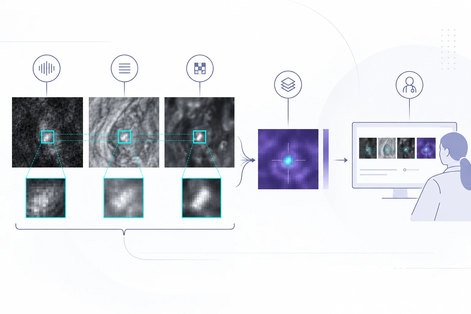 Diagram relating complementary MRI channels and localized image evidence.